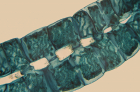 5_Frame_Spirogyra_NFO